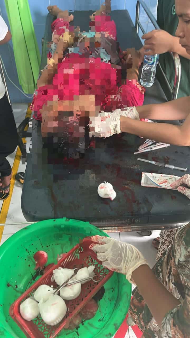 Pembunuhan Sadis di Aceh Tenggara, 5 Orang Tewas, 1 Luka Berat, Polres Agara Buru Pelaku